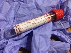 HbA1c or Hemoglobin A1c for diagnosis of type 2 diabetes